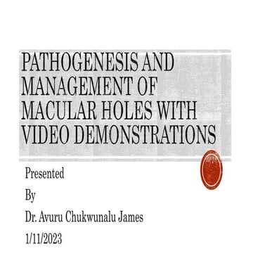 Pathogenesis and management of macular holes with video demonstration.pptx