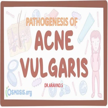 Acne Vulgaris | PPTX
