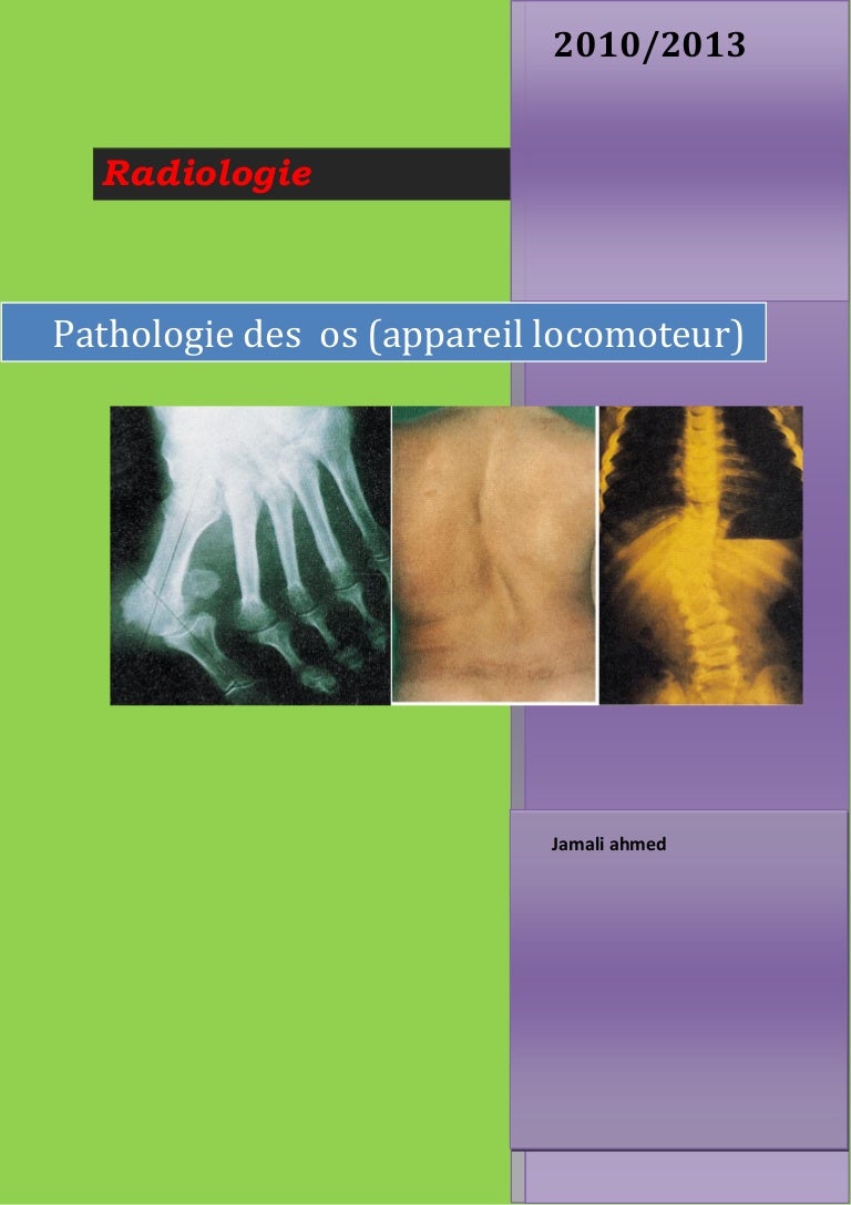 Pathologie De Lappareil Locomoteur - 