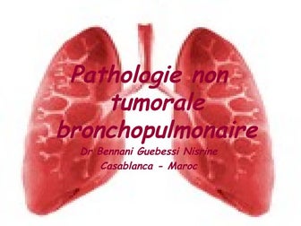 Pathologie Non Tumorale Bronchopulmonaire