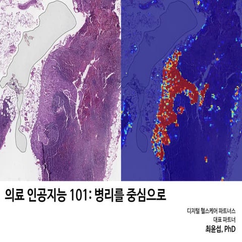 [대한병리학회] 의료 인공지능 101: 병리를 중심으로