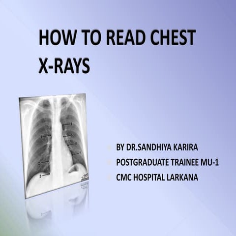 RIBS STERNUM X RAY PROJECTIONS . | PPTX