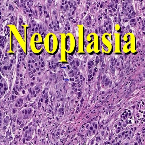 Pathology  neoplasm