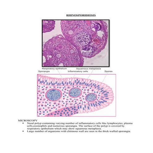Cytopathological pattern in cytology pathology | PPTX
