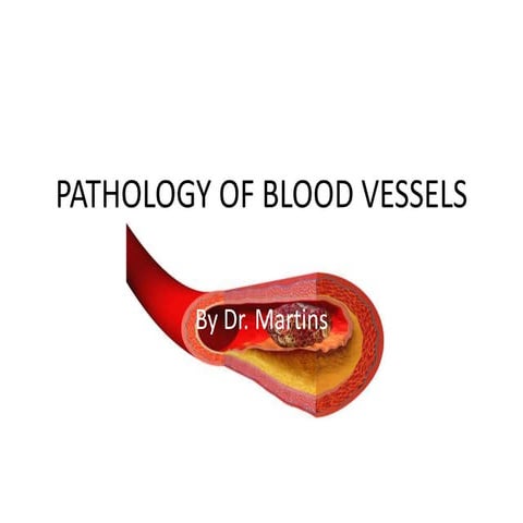 Pathology of blood vessels
