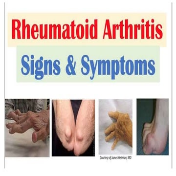 Rheumatoid arthritis RA Factor biochemistry .pptx