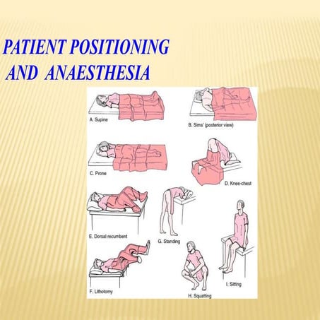 Patient position and anesthesia
