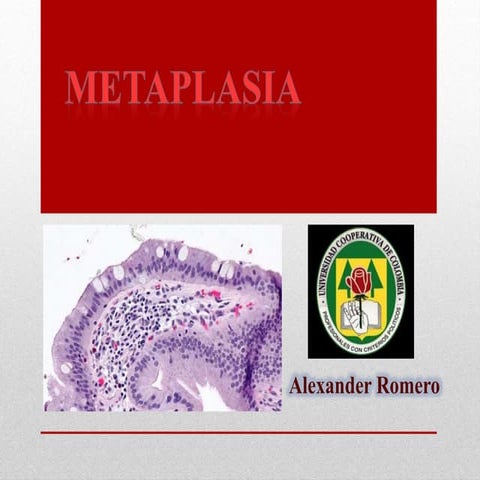 metaplasia final