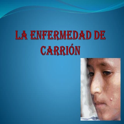  Enfermedad de Carrión