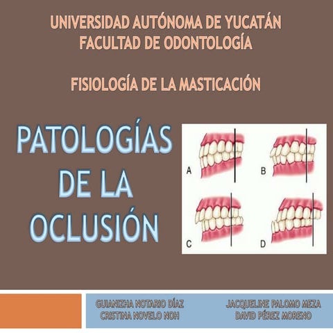 Resumen Final Oclusión Dental, RELACION CENTRICA, MAXIMA ...