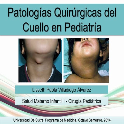Patologías quirúrgicas de cuello en pediatría | PPTX