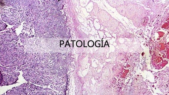 Laminas de la anatomia del corazón- Netter | PDF