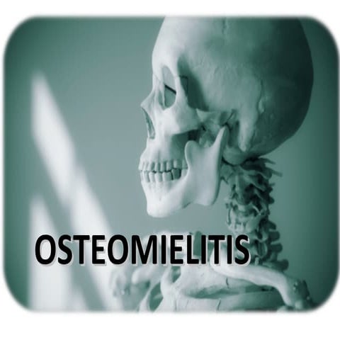 Osteomielitis 