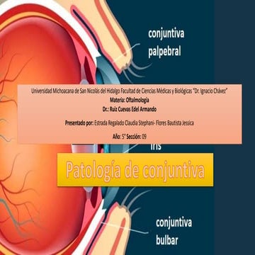 Patología de la conjuntiva.