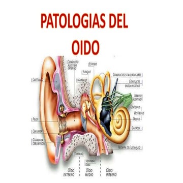 Patologia del oido