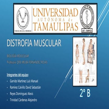 Patologia distrofia muscular | PPTX