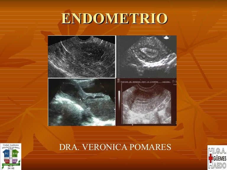 endometrio fino ahora que significa