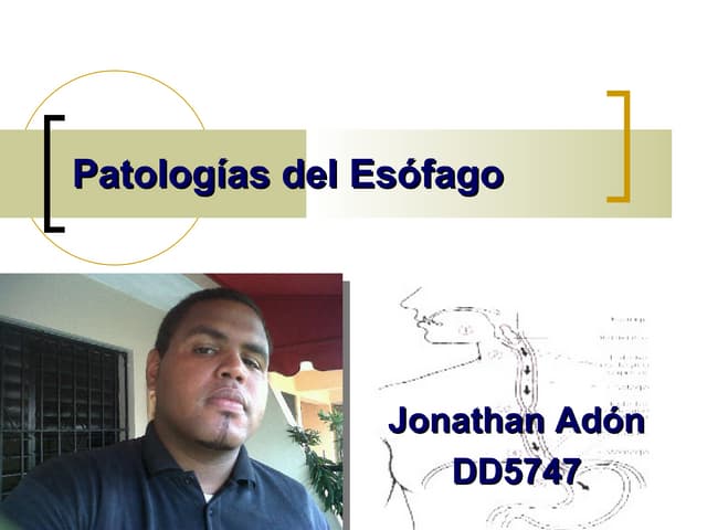 Patologias del esofago