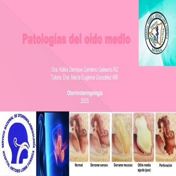 patologías del oído medio más frecuentes