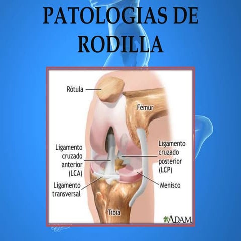 Patologias de rodilla