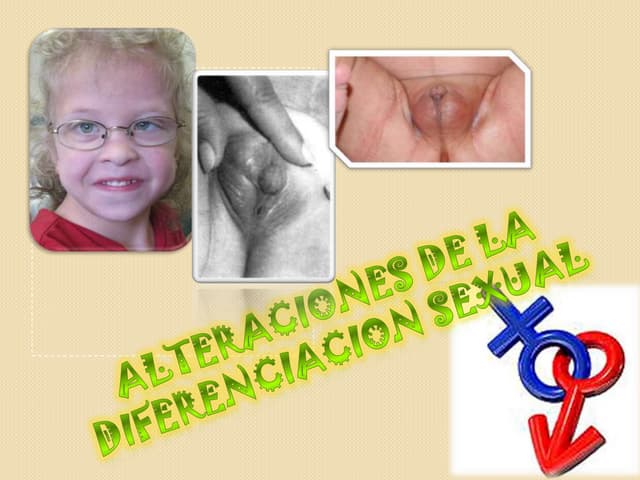 Patologia seudo hermafroditismo