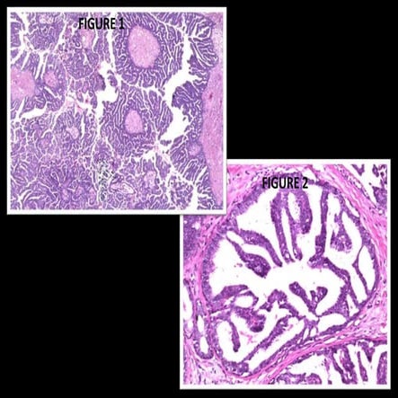 Patterns in histopathology