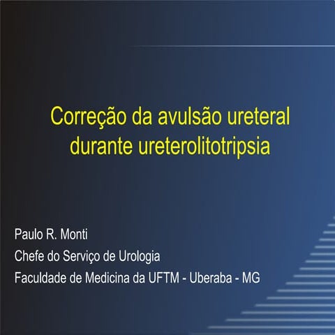 Correção da avulsão ureteral durante ureterolitotripsia