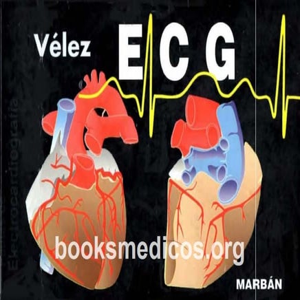 Pautas de ECG Velez 2ª Ed.pdf ,es un libro excelente
