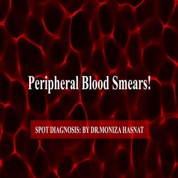 peripheral blood smear spot diagnosis | PPTX