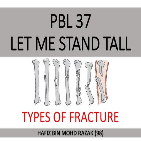 FRACTURE (TYPES AND PATTERN) | PPTX