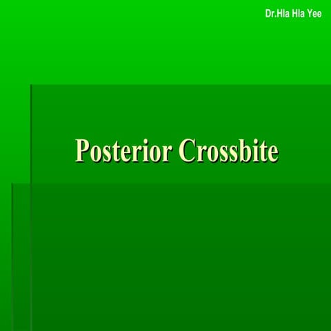Posterior Crossbite