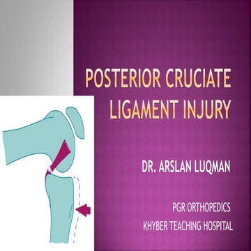 Posterior Cruciate Ligament Injury