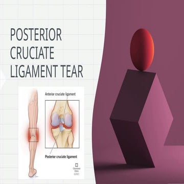 Arthroscopic pcl reconstruction | PPTX