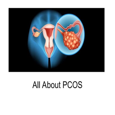 PCOS.ppt for gynaeoncology studies for students | PPT