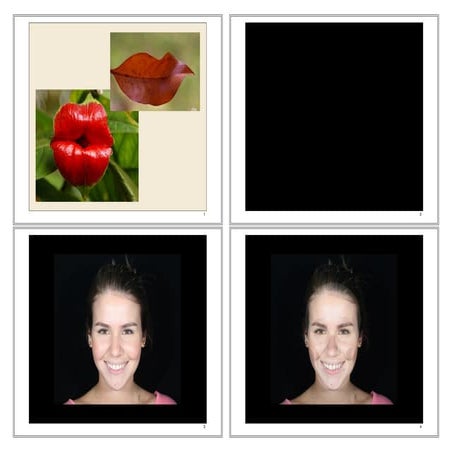 Oclusão FOUFF/NF - Guias Anteriores e considerações natureza e reabilitações