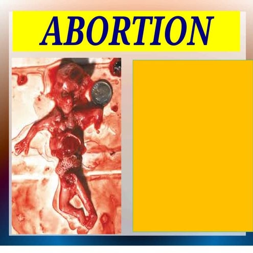 pdf ppt.pdf abortion it's type complication Management PDF