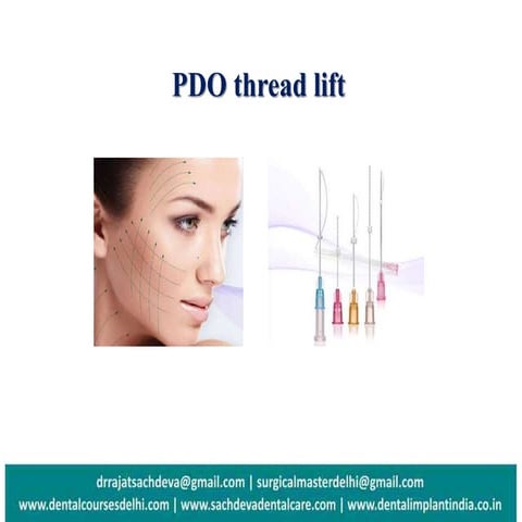 PDO Thread Lift