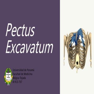 Pectus Excavatum