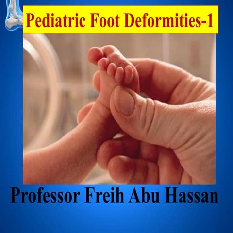 امراض القدم عند الاطفال Pediatric foot  1, البروفيسور فريح ابوحسان - استشاري ...