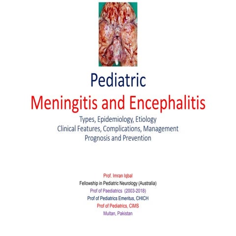 Pediatric meningitis and encephalitis 2021