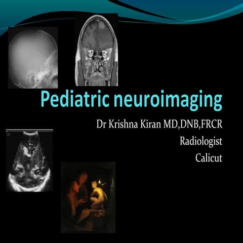 Pediatric neuroimaging