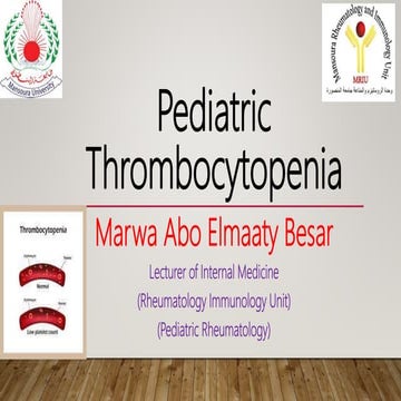 Pediatric thrombocytopenia