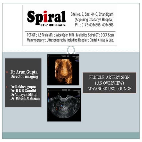 Pedicle  artery sign