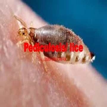 pediculosis treatment.pptx