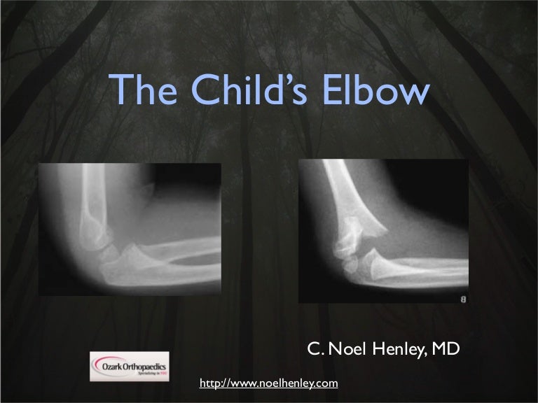 Pediatric Elbow Examination and Xrays