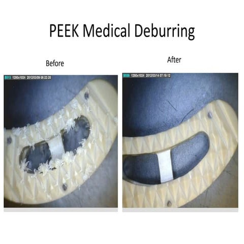 Peek medical deburring | PPTX