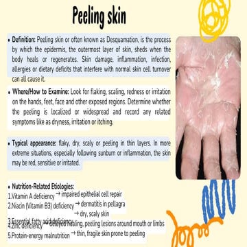 Understanding Peeling Skin: Causes, Symptoms, and Nutritional ...