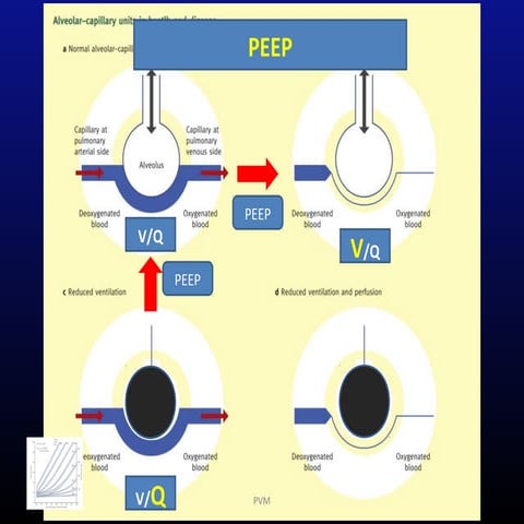 PEEP | PPT