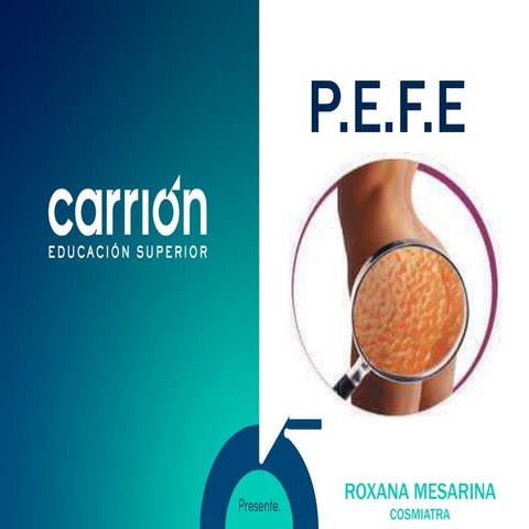 CARACT3RISTICAS DE PEFE CELULITIS 12.pdf