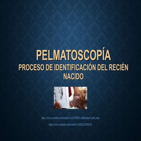 Pelmatoscopia